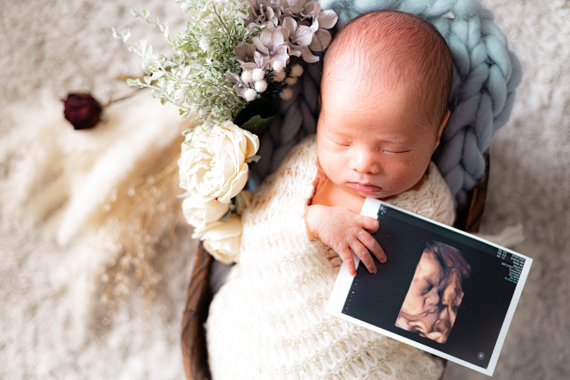 kudophotoが撮影した「ニューボーン＿まとめ」の写真