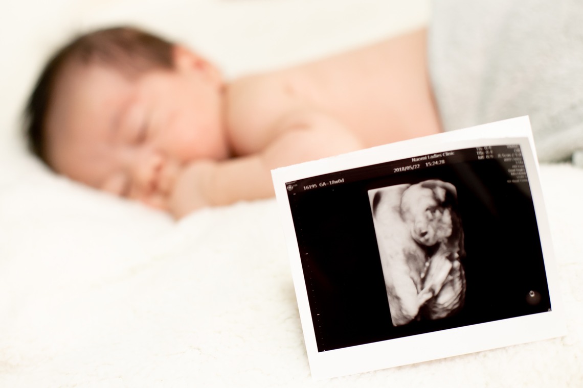 ゾクが撮影した写真のアルバム「ニューボーンフォト」