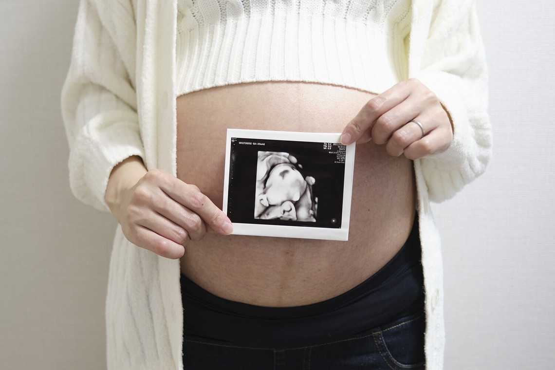 濱田茉里が撮影した「マタニティ」の写真