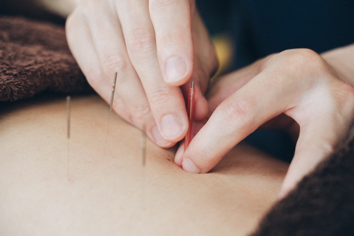 菊村夏水が撮影した写真のアルバム「鍼灸院」