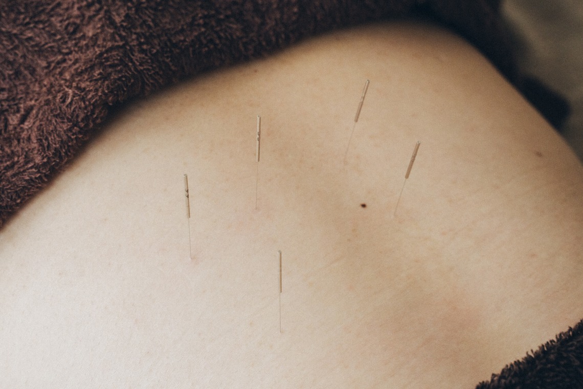 菊村夏水が撮影した写真のアルバム「鍼灸院」