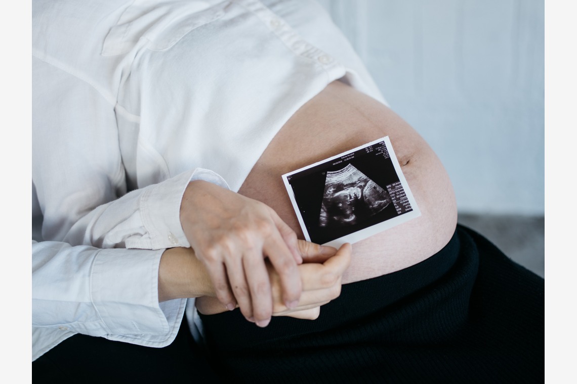 植村由理が撮影したマタニティフォトのアルバム「マタニティフォト@スタジオ」