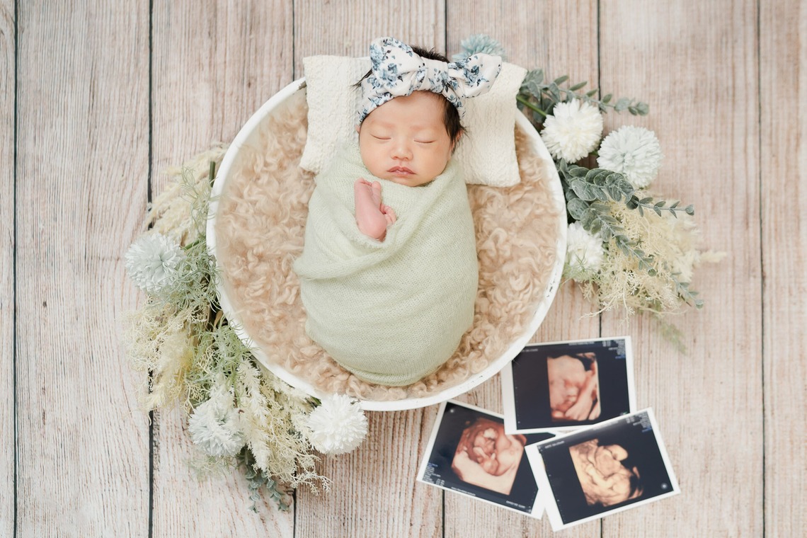 三谷 朋也が撮影した「ニューボーンフォト」の写真