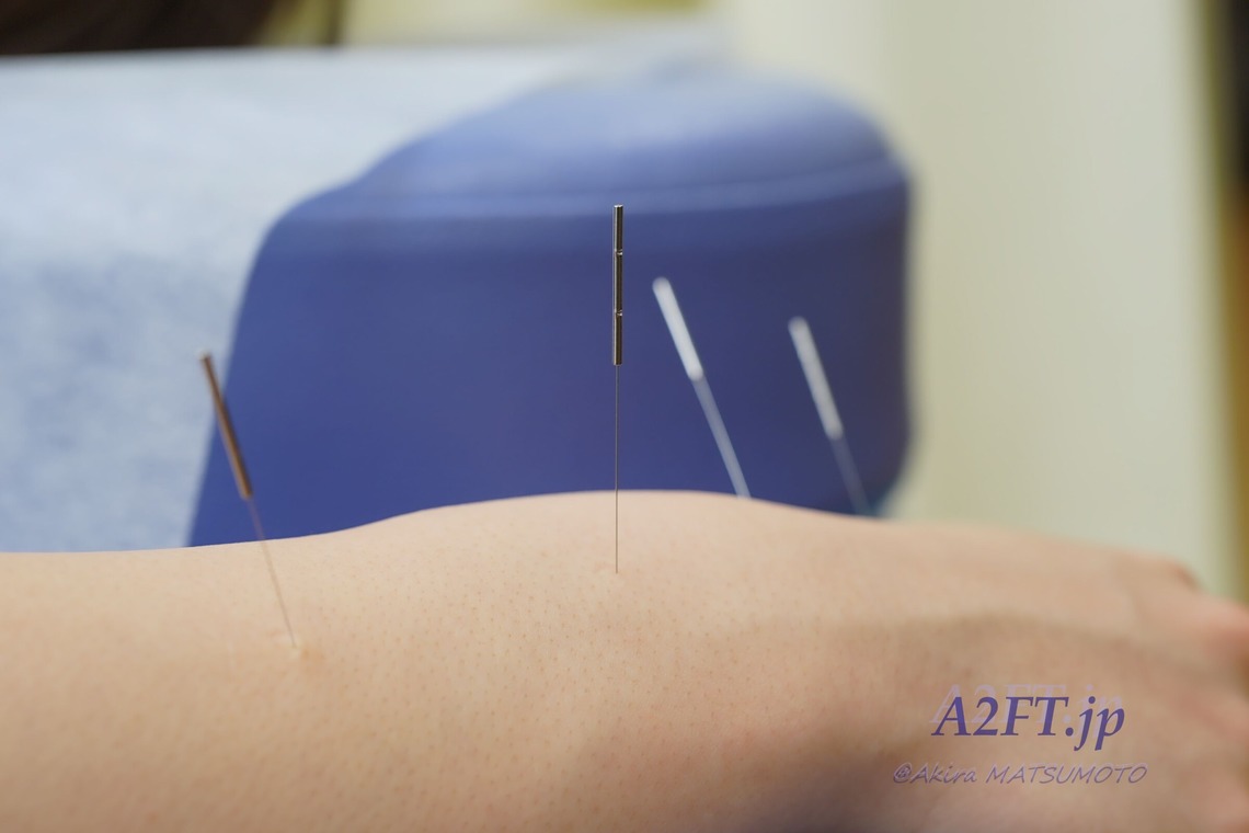 A2FT.jpフォトグラファーまつもとあきらが撮影した写真のアルバム「2021年2月 Bornbody鍼灸整骨院様」