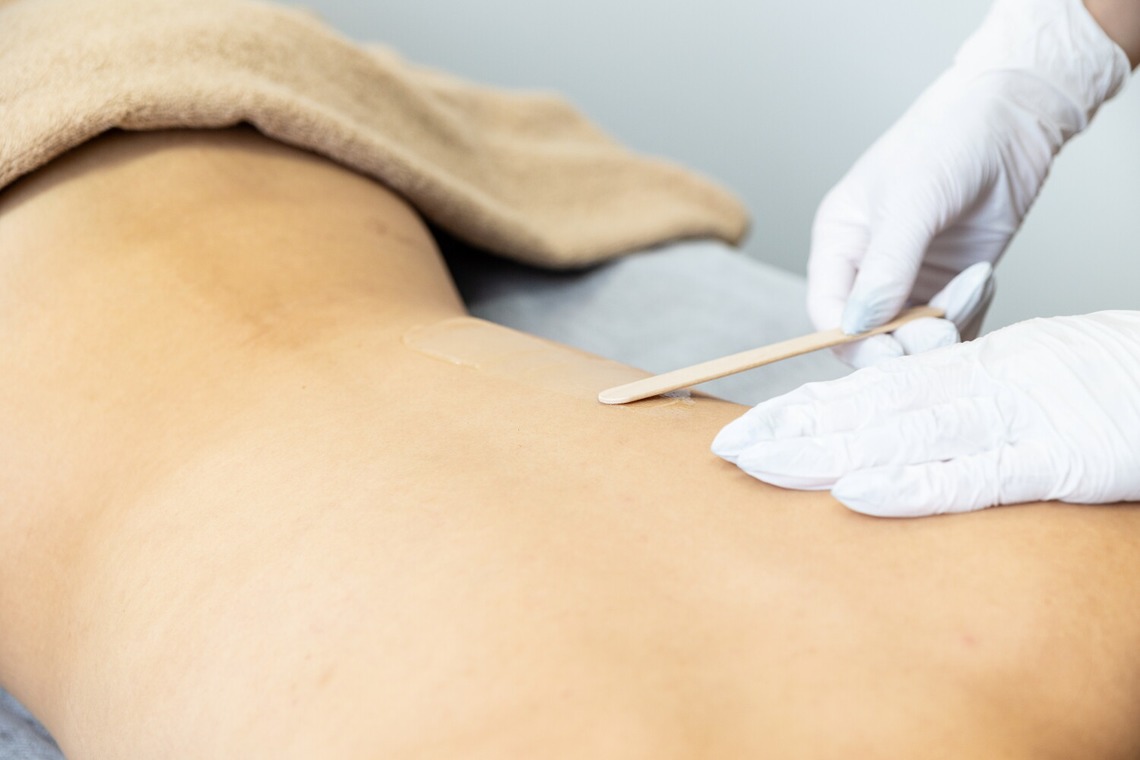 LUCE PHOTO WORKSが撮影した「医療脱毛」の写真