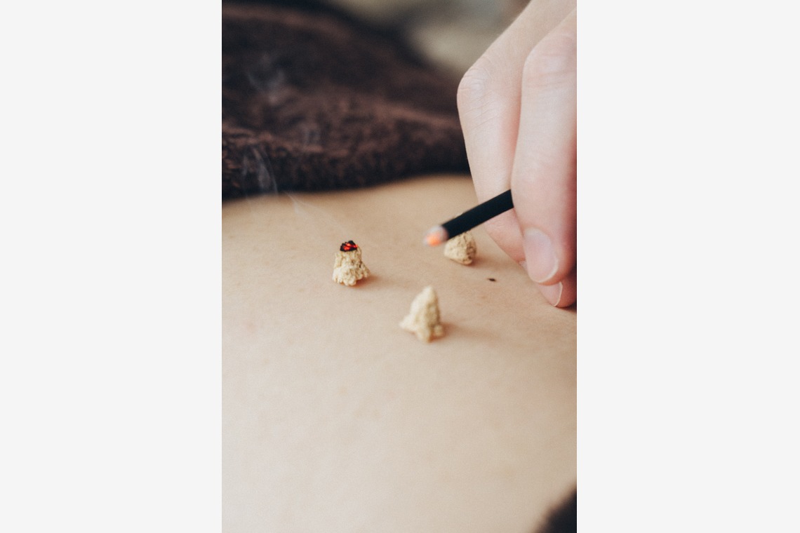 菊村夏水が撮影した「鍼灸院」の写真