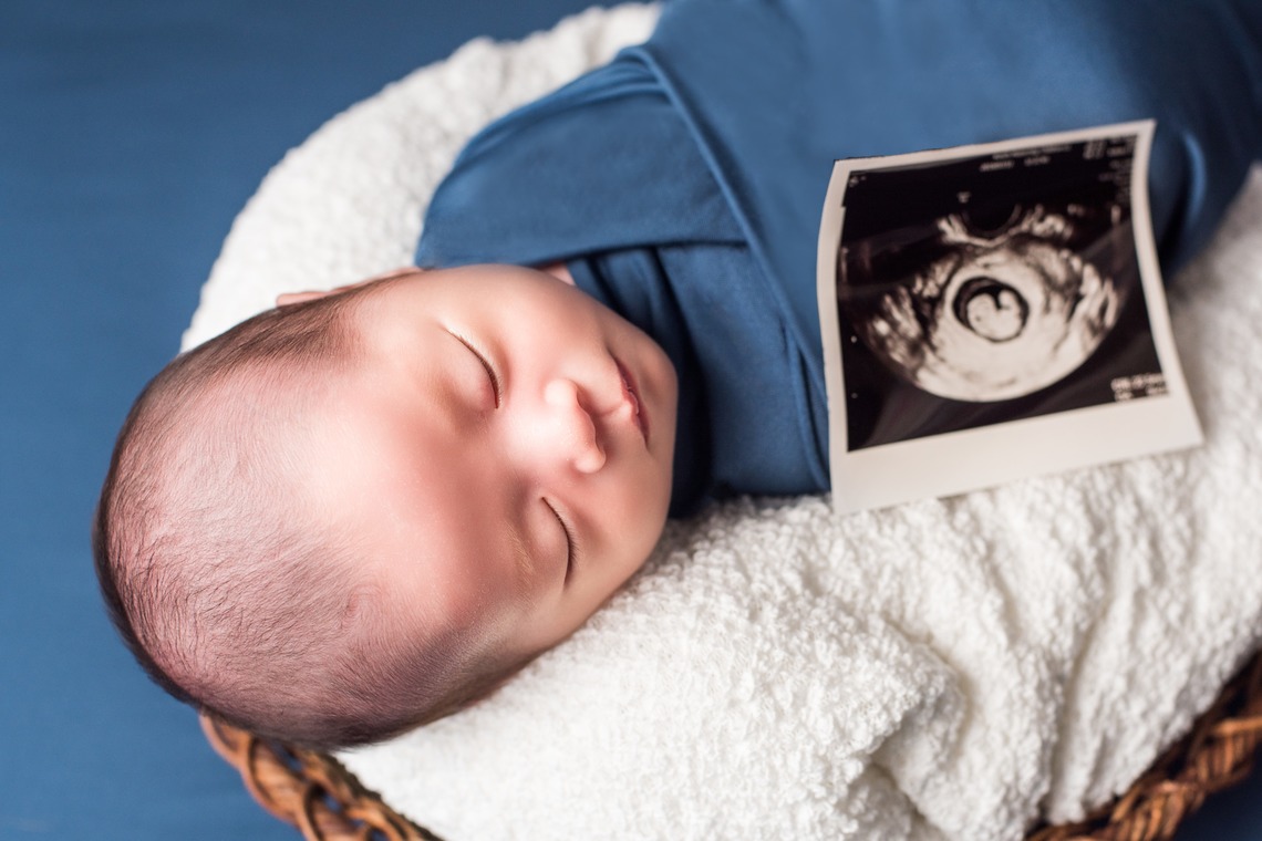 AXiS Photo Service 伊神 菜穂子が出張撮影した家族写真(キッズ,ベビーフォト)などが写った「＜アート性の高いニューボーンフォト＞ご自宅の4畳スペースが撮影スタジオに！」の家族写真