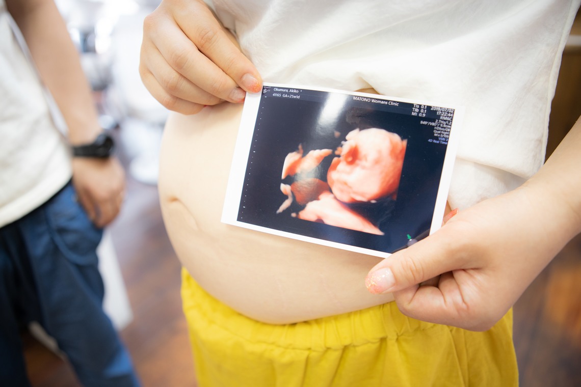 橋本祐里子（まるちゃん）が撮影した写真のアルバム「パパのお店でマタニティフォト」