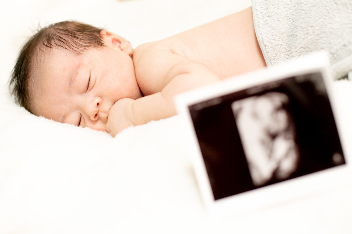 ゾクが撮影した写真のアルバム「ニューボーンフォト」