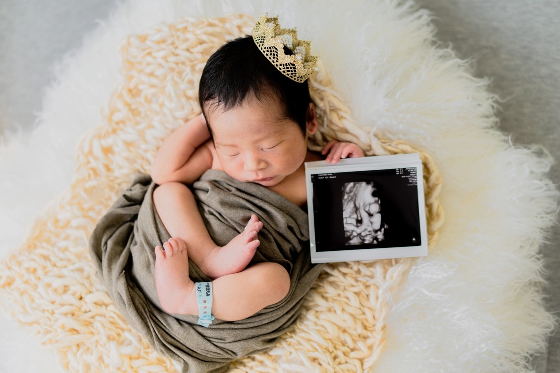 Kanaeruが撮影した写真のアルバム「赤ちゃん誕生の感動を写真に込めて」