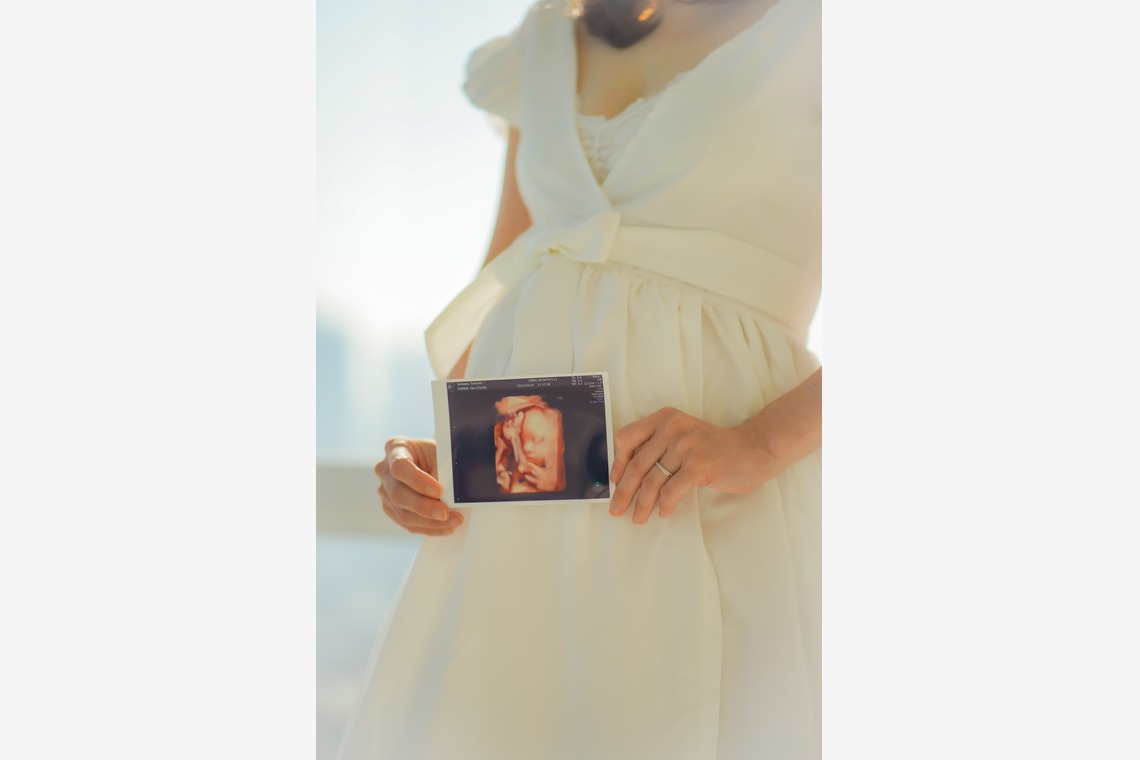 合同会社Joy Stormが撮影した写真のアルバム「マタニティフォト」