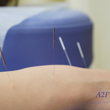 A2FT.jpフォトグラファーまつもとあきらが撮影した「2021年2月 Bornbody鍼灸整骨院様」の写真