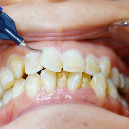 河野慈圓が撮影した「:albumName」の写真