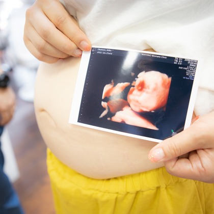 橋本祐里子（まるちゃん）が撮影した「:albumName」の写真