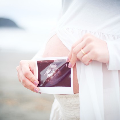 アトリエ　エピカ/清水　一哉が撮影した「:albumName」の写真