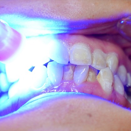 河野慈圓が撮影した「:albumName」の写真