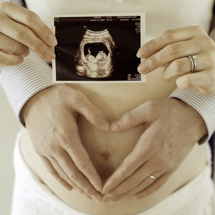 Michi Photographyが撮影した「ウェディング・結婚」のウェディングフォト - :albumName